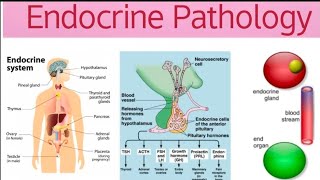 Endocrine Pathoma 4  Thyroid Neoplasms amp Parathyroid Gland [upl. by Drescher713]