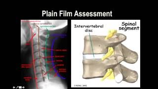 Cervical Spine XRay [upl. by Athiste]