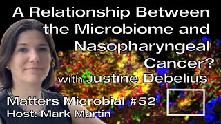 Matters Microbial 52 A relationship between the microbiome and nasopharyngeal cancer [upl. by Yennej]