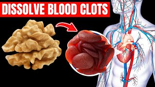 TOP 10 Foods To DISSOLVE Your BLOOD CLOTS You Need to Eat NOW [upl. by Alleinnad148]