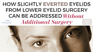 Ectropion and Lower Lid Retraction after Eyelid Surgery  Diagnosing Severity and Need for Revision [upl. by Collum]