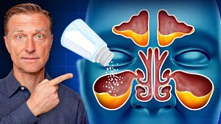 Rid Throat and Sinus Mucus with SALT [upl. by Shuler]