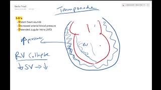 Cardiac Tamponade  Dr Jamal USMLE [upl. by Jeddy]