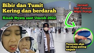 GANGGUAN KESEHATAN SAAT UMROH 2022  Perlengkapan wajib dimiliki saat umrohhaji [upl. by Nairbal]