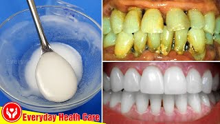 Use Only This Toothpaste  Remove Tartar And Whiten Teeth Quickly [upl. by Huppert218]