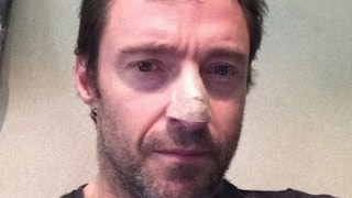 Hugh Jackman Reveals Skin Cancer Diagnosis [upl. by Sacci]