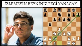 İzlemeyin Beyniniz Feci Yanacak [upl. by Dyrraj770]