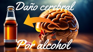 La encefalopatía de Wernicke enfermedad cerebral mortal [upl. by Enitsenre]