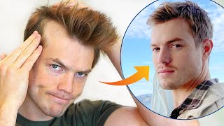 How I Stopped My Receding Hairline Mens Hair Loss Guide [upl. by Doralynne810]