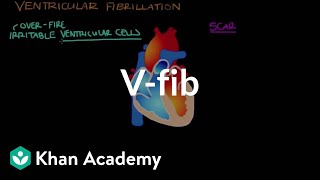 What is ventricle fibrillation Vfib  Circulatory System and Disease  NCLEXRN  Khan Academy [upl. by Aicetal]