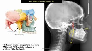 Identifiable anatomical structures in lateral cephalometric radiograph ceph tracing 1 [upl. by Airehc]