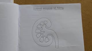 Kidney Renal Disease Signs amp Symptoms ex Peripheral Edema Fatigue Itchiness [upl. by Ellan]