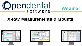 Open Dental Webinar  XRay Measurements and Mounts [upl. by Oremo]