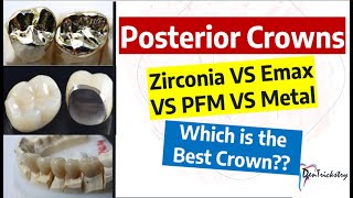 DENTAL CROWN TYPES Zirconia Emax PFZ PFM Metal Choosing the BEST [upl. by Hatcher]