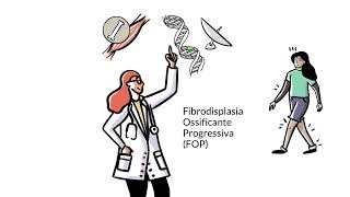 Saiba mais sobre Fibrodisplasia Ossificante Progressiva FOP [upl. by Oringas]