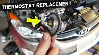 HYUNDAI ELANTRA TUCSON THERMOSTAT REPLACEMENT LOCATION [upl. by Zahara]