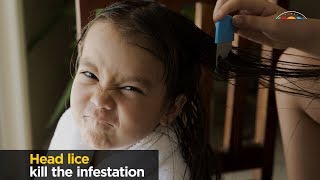 HEAD LICE Causes Signs and Symptoms Diagnosis and Treatment [upl. by Anait60]