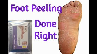 How to Get Rid of Dry Cracked Feet FAST amp NATURALLY  AT HOME Remedies amp MORE [upl. by Arzed680]