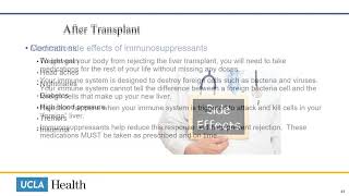 Cirrhosis – What is a TIPS procedure [upl. by Nosreffej]