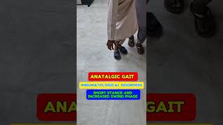 Antalgic gait video of patient  analysis example  description and pattern of Gait gait [upl. by Akemhs428]