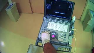 7 Adjusting Ultrasound Machine Settings [upl. by Junius250]