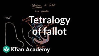 Tetralogy of fallot  Circulatory System and Disease  NCLEXRN  Khan Academy [upl. by Felipe626]