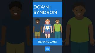 DownSyndrom Behandlung  Kenhub downsyndrom [upl. by Airbma]