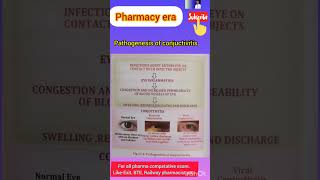 Acute Conjunctivitis Pink Eye  Allergic Bacterial Viral  Symptoms Diagnosis Treatment [upl. by Adnanref685]