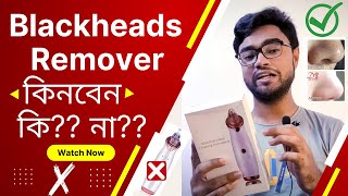 Multifunctional cleaning instrument  মুখের ব্লাকহেডস দূর করার উপায়  blackhead removal review [upl. by Lenwood]