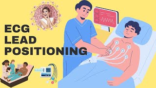 Mastering ECG Lead Placement [upl. by Bryce]