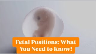 Understanding Fetal Positions What You Need to Know baby pregnant fetaldevelopment [upl. by Akitahs136]