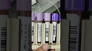 HbA1C Test Hematology Lab resultD 10 [upl. by Royden]