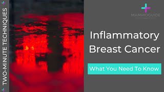 Two Minute Techniques  Inflammatory Breast Cancer [upl. by Etra680]