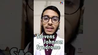 Stevens Johnson Syndrome  Sulfonamide  Penicillin  Antibiotics  Adverse effects [upl. by Reisch966]