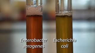 Demo Biochemical Tests  Voges Proskauer Test [upl. by Jarek]