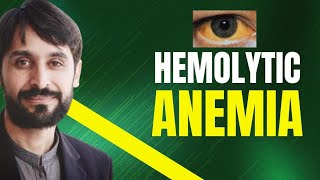 Hemolytic Anemia  Causes  Symptoms  Diagnosis and Treatment  MLT Hub with kamran [upl. by Lirrehs]