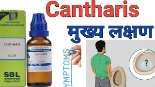 Cantharis 30200ch q mother tincture homeopathy medicine uses in hindi [upl. by Lanoil223]