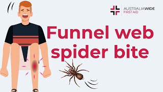 Funnelweb Spider Bite  First Aid [upl. by Forsta172]