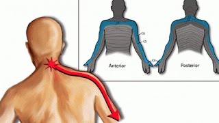 Terapia manual para cervicobraquialgia o Epicondilitis [upl. by Grubb447]