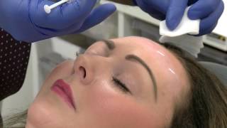 Injecting Botox To The Forehead  Training Video For Medical Professionals Only [upl. by Annabella]