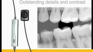 Kodak RVG Digital Intra Oral sensor [upl. by Haididej]