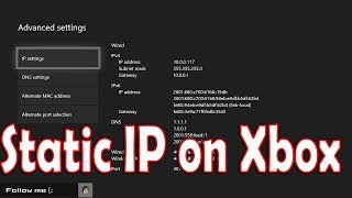 How to Setup Static IP on Xbox One [upl. by Secnarf411]