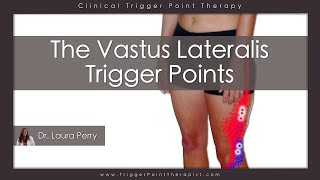 The Vastus Lateralis Trigger Points [upl. by Nevag561]