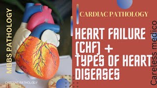 CARDIAC PATHOLOGY Heart Failure CHF  Types of Heart Disease lecture 8pathology pathoma cvs [upl. by Nosittam]