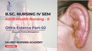 Otitis Externa Part2  Diagnosis Finding Management  Valinee Nursing Academy [upl. by Erdnaid]