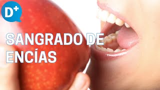 Enfermedades periodontales ¿Por qué nos sangran las encías [upl. by Huei]