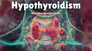 Hypothyroidism  Symptoms Causes Treatment amp Medication [upl. by Asiluj]