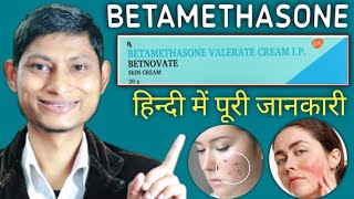 betamethasone valerate cream ip  betamethasone dipropionate cream  betnovate cream ke fayde [upl. by Ancelin45]