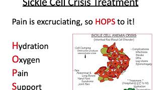 Sickle Cell Crisis NCLEX [upl. by Brigitta]