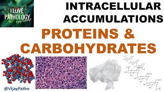 INTRACELLULAR ACCUMULATIONS Proteins amp Carbohydrates [upl. by Jecoa]